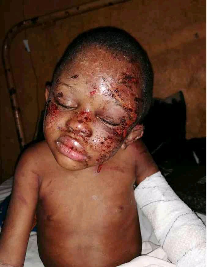 HORRIFIC!!! See The Faces Of Bloodied Children Rescued From The House Of The Ritualist Prophetess