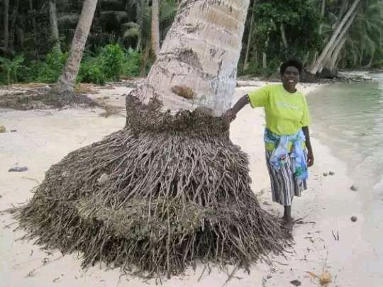 The Power Of Coconut Roots - It Can Get Rid Of All Urinary Tract Infections And 3 Other Diseases