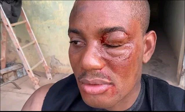 OMG!!! Alex Ekubo Beaten To A Pulp - See How Pitiful He Looks