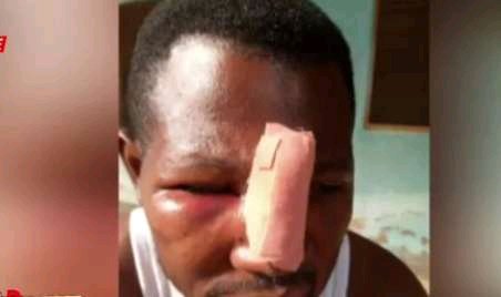 Again: Secondary School Student And His Gang Attack Teacher Over Refusal to do Assignment