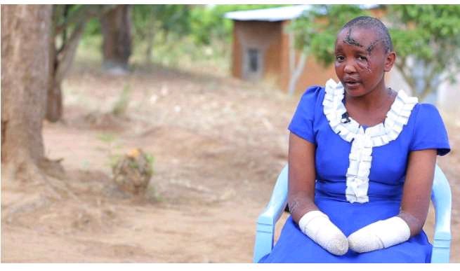 Woman Whose Hand Was Cut Off Because She Was Barren is Now Pregnant For Another Man 