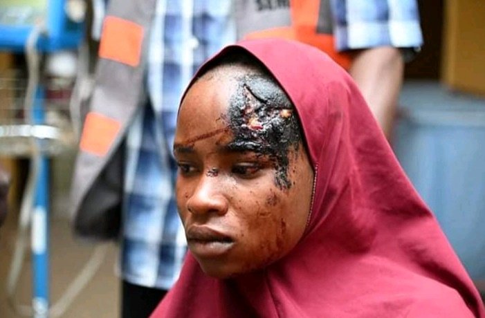 "I Watched My Sister Die"- Woman Who Survived Boko Haram Resent Attack In Yobe Shares Her Story