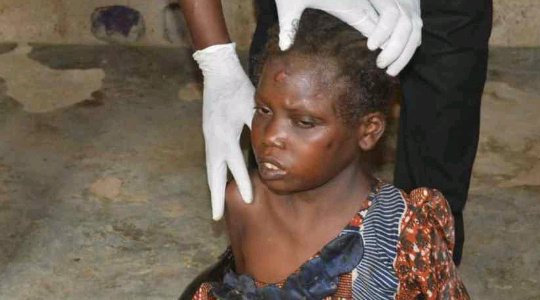 Heartless: See the Girl Locked in A Room for 10 Years By Her Parents Rescued by Police in Kano