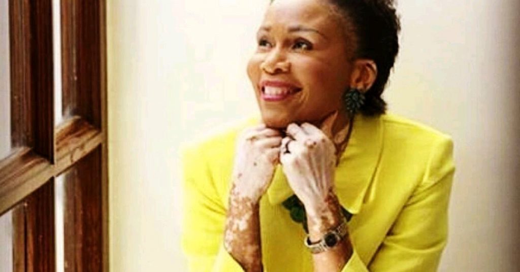 SAD! Do You Remember The Lady Who Acted Sarafina, See What Happened to Her Out After 29 Years 