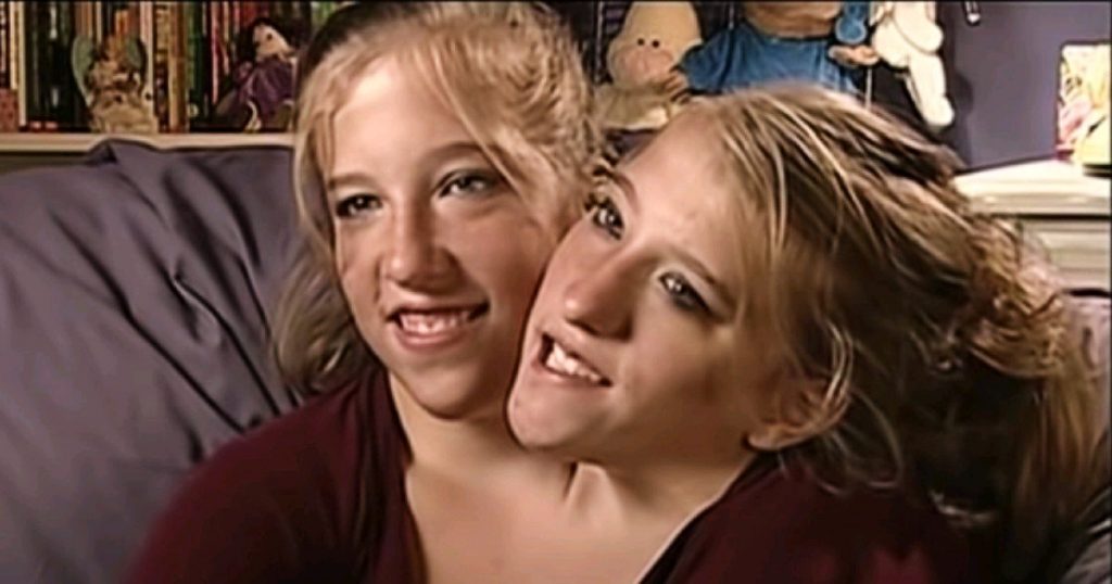 Celebrity Twins Abby And Brittany Share the Interesting Experience of Being Conjoined Twins