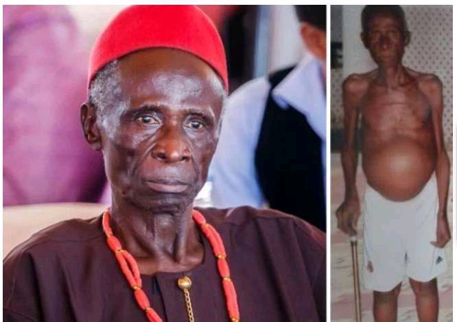 Sad - 5 Nollywood Actors Who Died Sick After Begging For Financial Help For Treatment