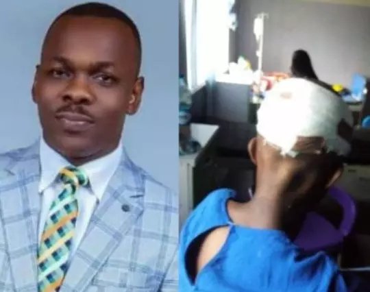 See the Face Of Living Faith Pastor That Broke His House Girl's Head Because of Garri
