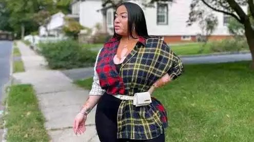 Lady Suffering From Vitiligo A Skin Condition Shares Adorable Photos