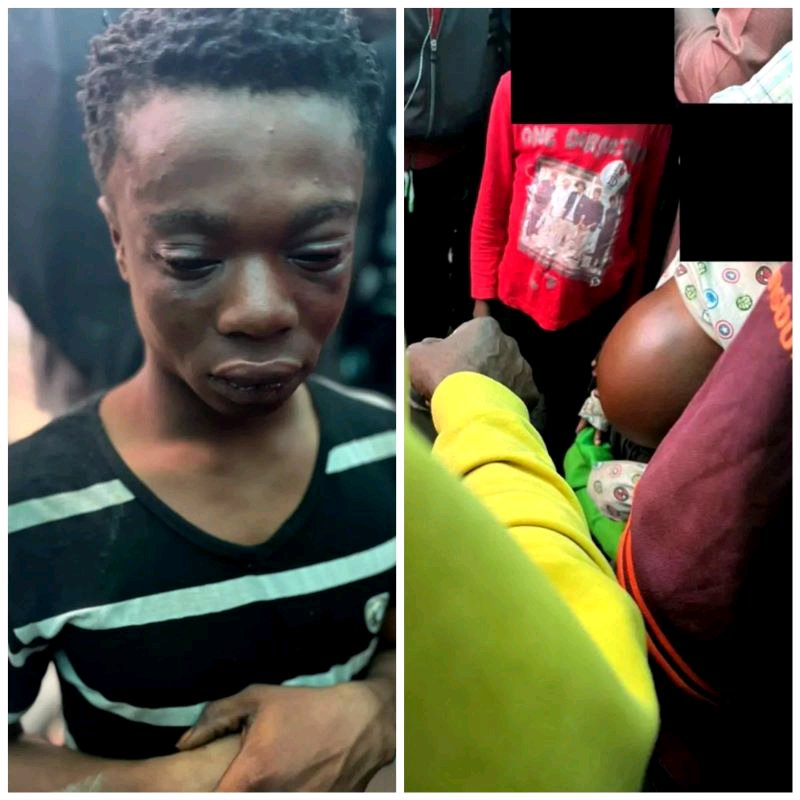My Oga Gives Them Medicine That Makes Their Belly Swell - Man Who Uses Children With Fake Tumour to Beg Confesses