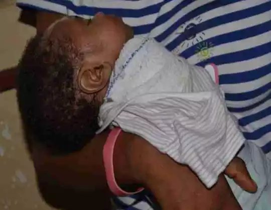 VIDEO: After Bre@king The B@by's Hand, He Used Rubber Band And Stick To Hold It Together– Mother of Amputee Baby Cries Out