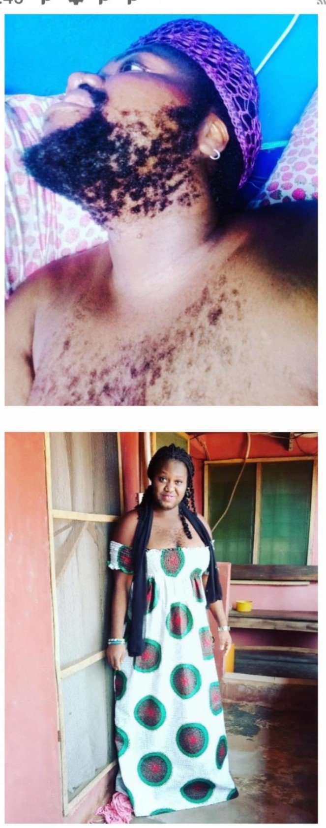 "I Want to Look Like A Woman", Nigeria’s Hairiest Woman - Queen Okafor Finally Shaves off Her Beards