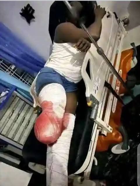 Drunk Driver in Jos Mows Down Three Friends After Football Match, Victims Lose Legs