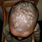 12 Sicknesses You Can Treat Locally Using Aloe Vera