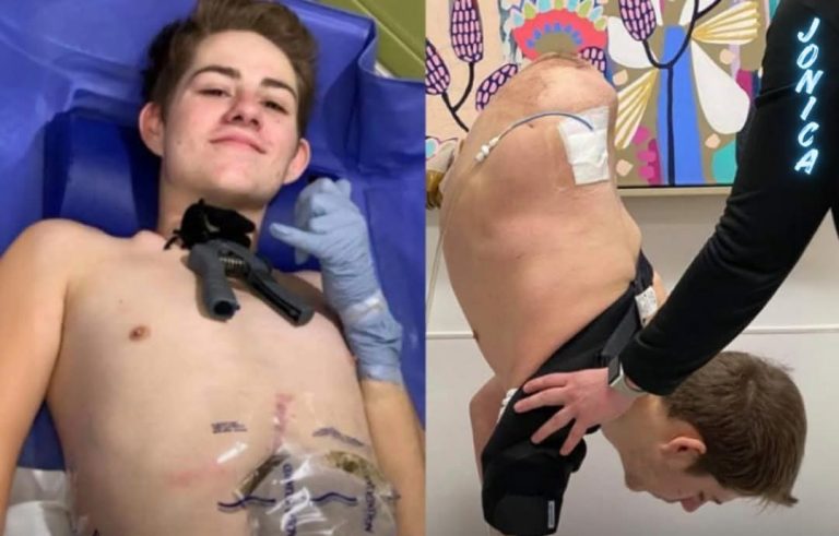 “I Survived Being Cut in Half by a Forklift”: A Young Man’s Story of Loss and Resilience