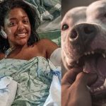Woman Bitten 40 Times While Saving an Infant from Pit Bull Attack Receives Car and Furnished Apartment