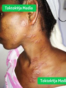 How My 15 Year Old Daughter Contacted HIV – Father’s Agony After Daughter’s HIV Reveals Five-Year Abuse