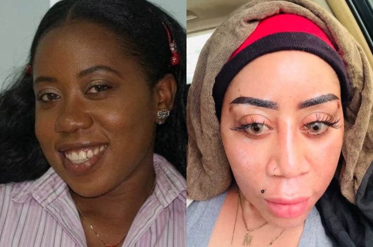 Moyo Lawal Responds to Critics as Before and After Images Go Viral