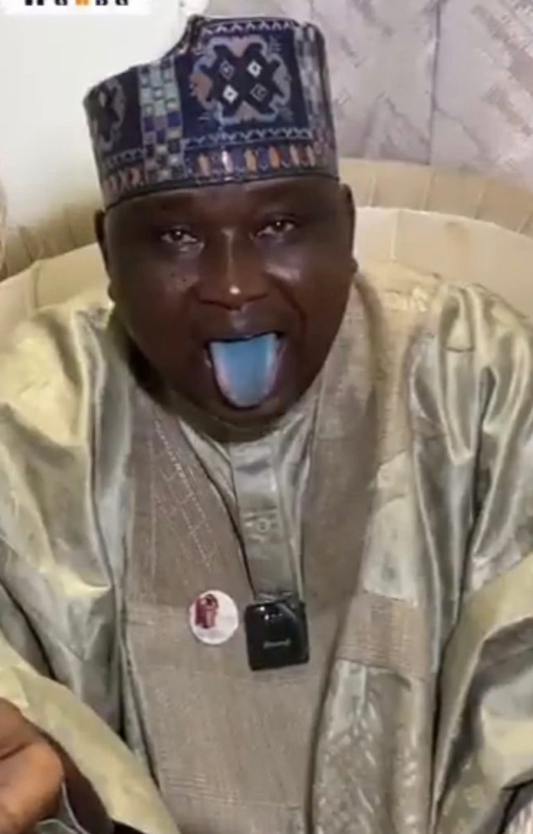 “It is the work of the devil and my political enemies” – Kano Rep opens up about blue tongue during primaries