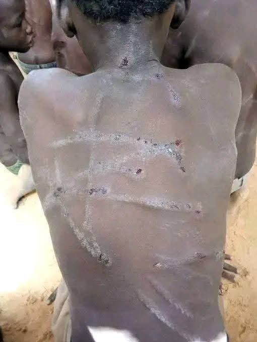 “They Set Fire to Their Bodies” – Photos Show Oyo School Children Beaten, Burned with Hot Plastic as Government Promises Rescue