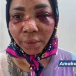 Lagos Woman Accuses Ex-Friend Of Kidnap Plot, Robbery And Attempted Murder After ‘Reconciliation’ Meeting