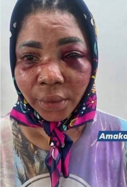 Lagos Woman Accuses Ex-Friend Of Kidnap Plot, Robbery And Attempted Murder After ‘Reconciliation’ Meeting