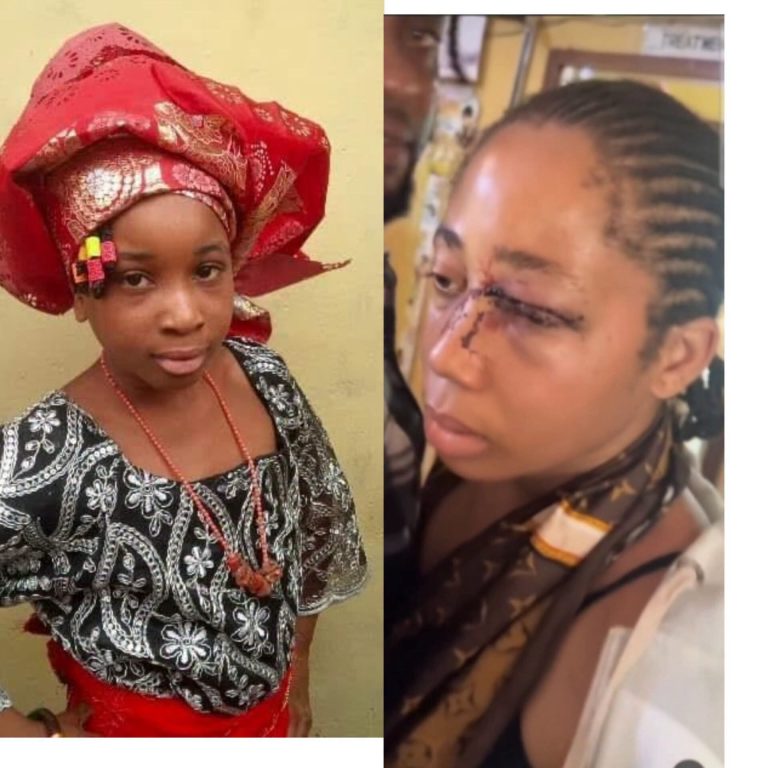 “I Beg You, Don’t Arrest Him”: 18-Year-Old Abuse Wife Pleads for Husband Despite Severe Injuries – Video