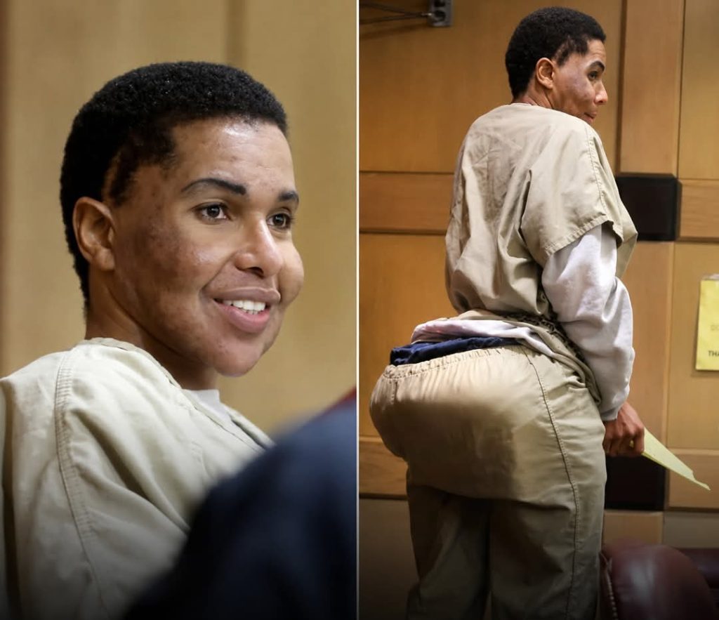 Fake Doctor Sentenced to 10 Years in Jail For Injecting Patients with Cement and Super Glue During Plastic Surgeries