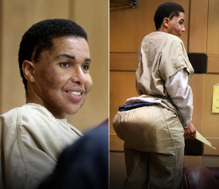 Fake Doctor Sentenced to 10 Years in Jail For Injecting Patients with Cement and Super Glue During Plastic Surgeries