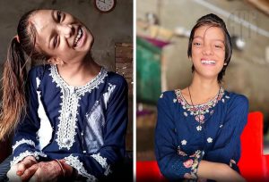Afsheen Gul Could Not Hold Her Head Upright for 12 Years – Then a Delhi Surgeon Offered Her a Second Chance