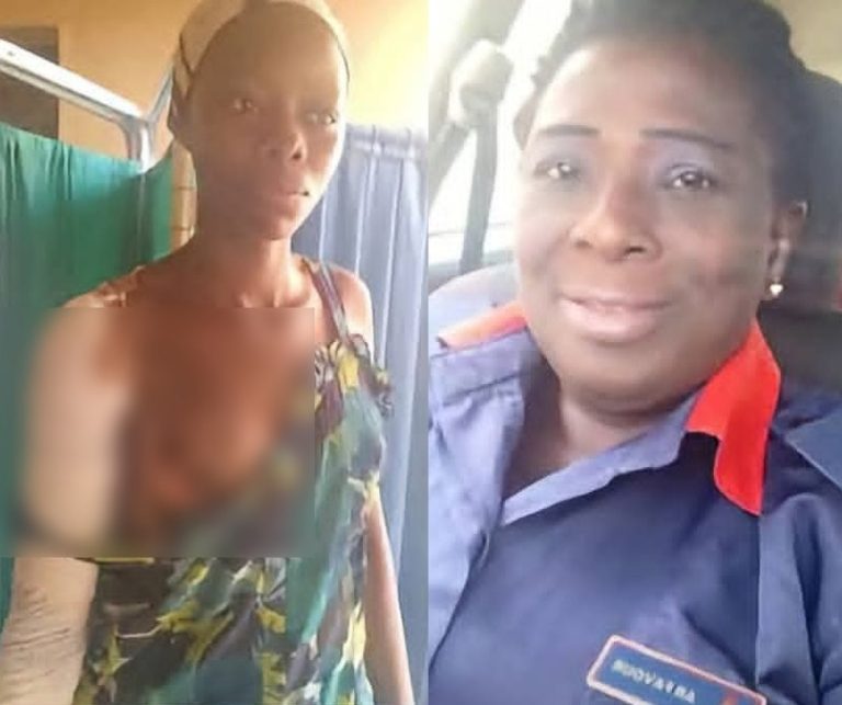 Outrage as Civil Defence Chief Superintendent Accused of Scalding Teenage Maid With Hot Water